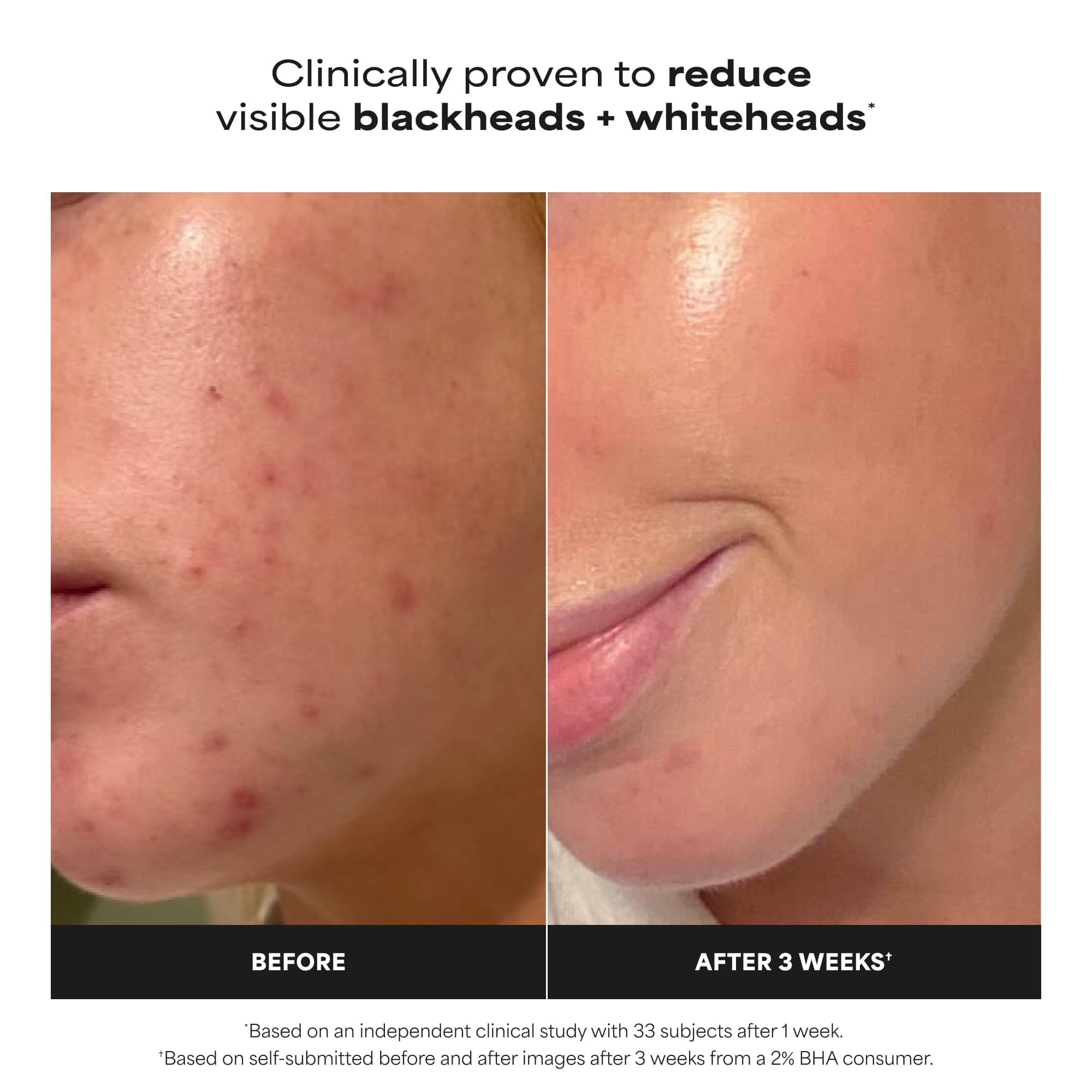 Paula's Choice SKIN PERFECTING 2% BHA Liquid Exfoliant, 4 Fl Oz, view 2