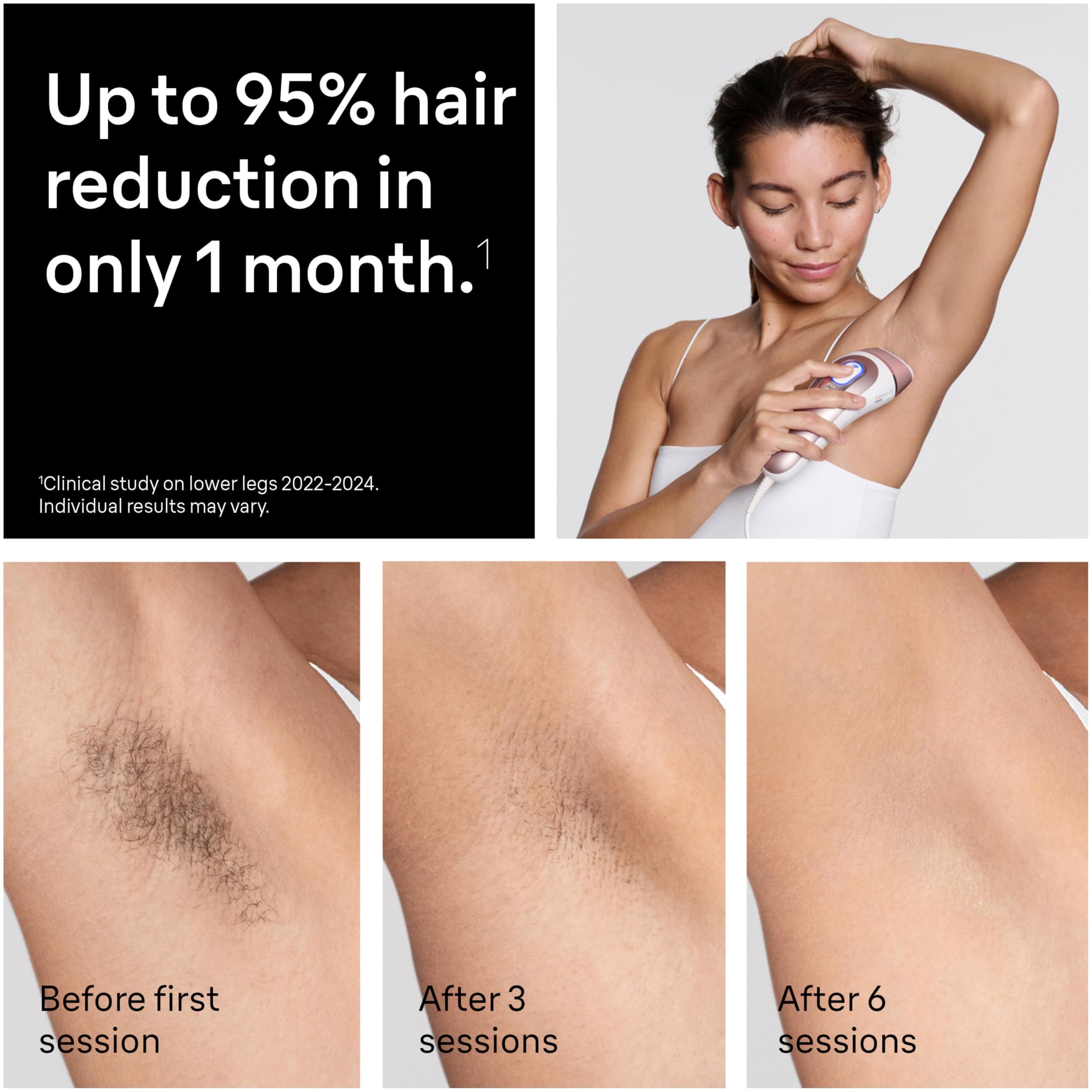 Braun Skin i-Expert Smart IPL PL7219 at Home Laser Hair Removal for Women and Men with App, Premium Pouch, Venus Razor, 2 Smart Heads, Facial Trimmer, view 3