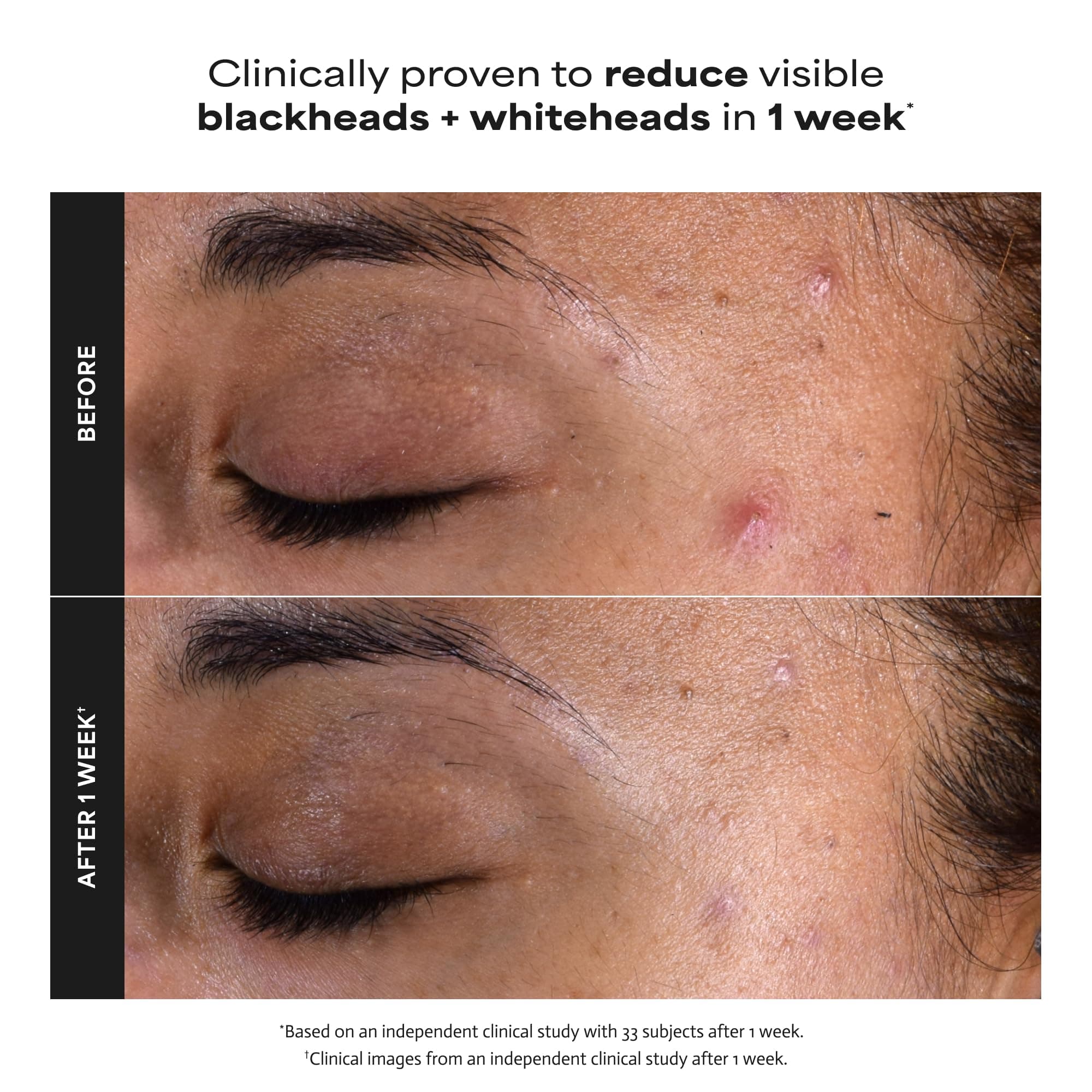 Paula's Choice SKIN PERFECTING 2% BHA Liquid Exfoliant, 4 Fl Oz, view 4