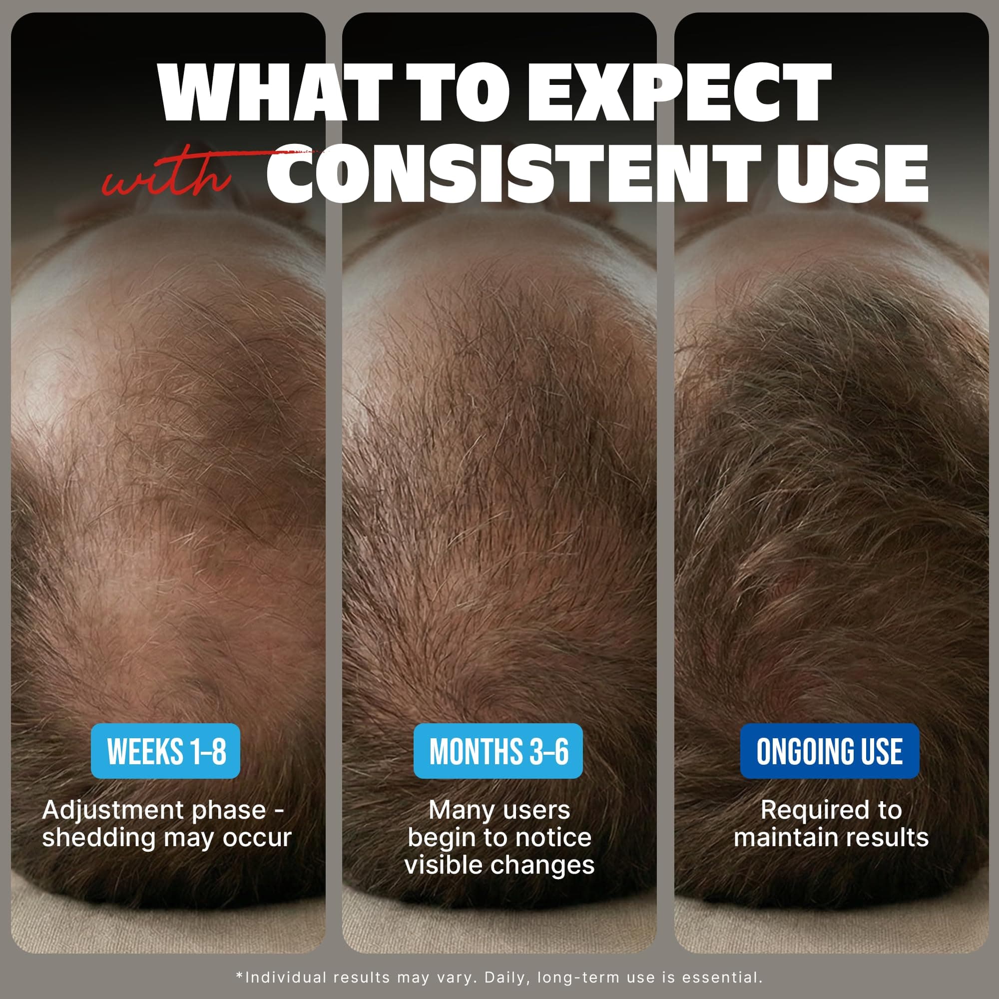 Kirkland Minoxidil for Men Liquid, Extra Strength Hair Regrowth Treatment 5%, 6 Months Supply - Upgraded Dropper Applicator and Bonus Free Guide Included, view 4