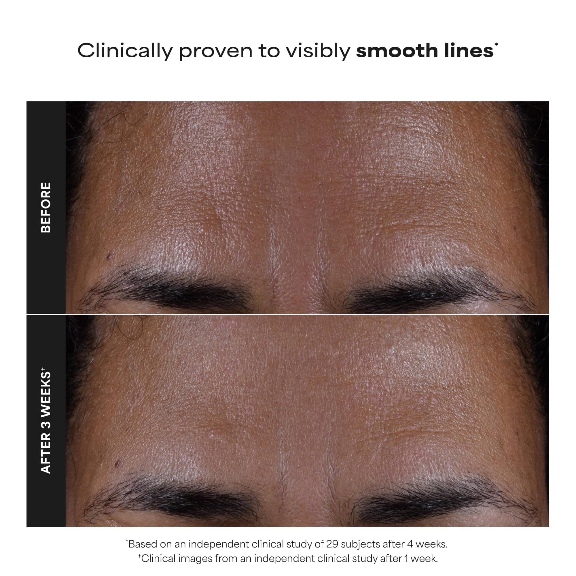 Paula's Choice SKIN PERFECTING 2% BHA Liquid Exfoliant, 4 Fl Oz, view 3