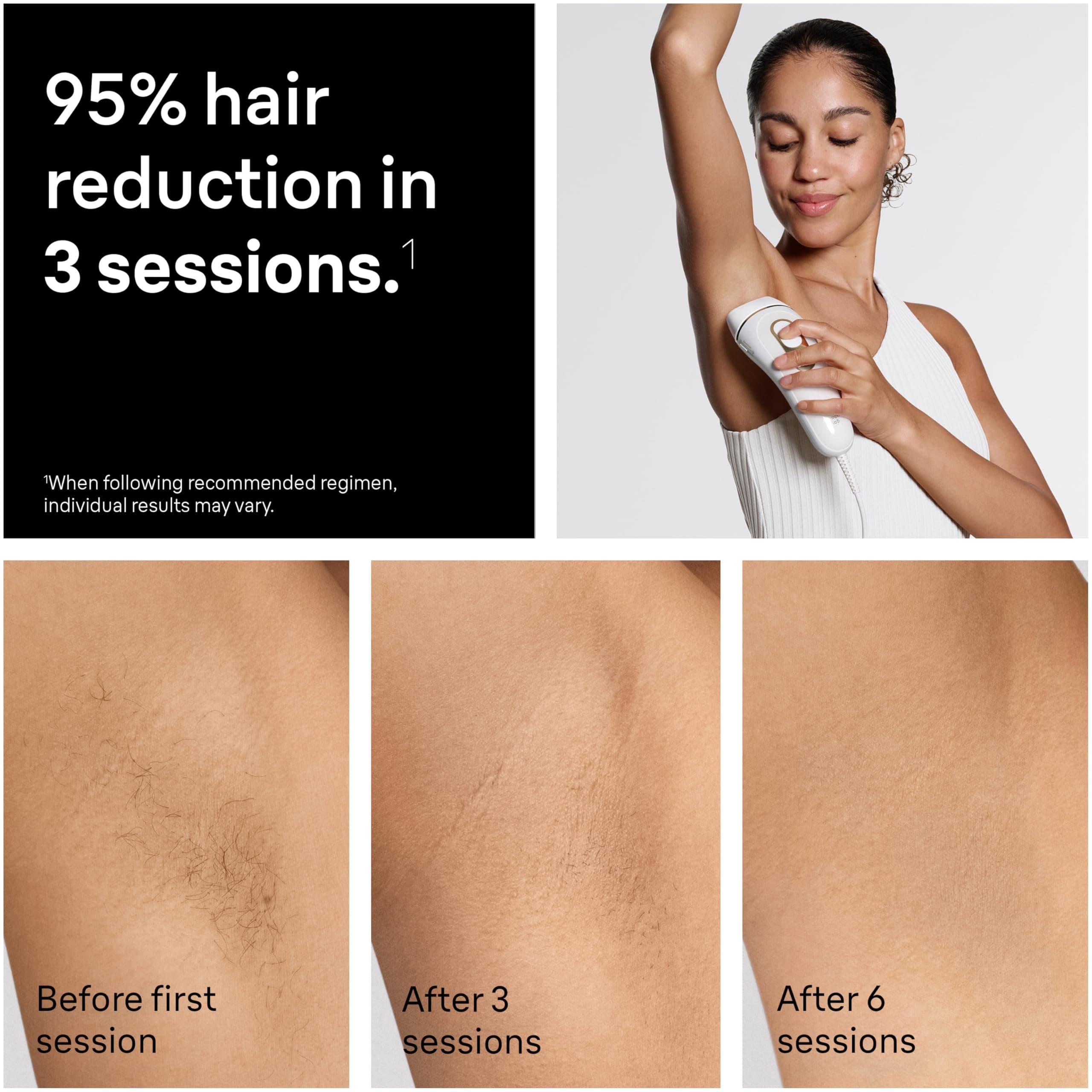 Braun IPL, Silk·Expert Pro 5, IPL Hair Removal for Women and Men, Permanent Laser Hair Reduction At-Home, 2 Heads, Pouch, IPL5137, view 4